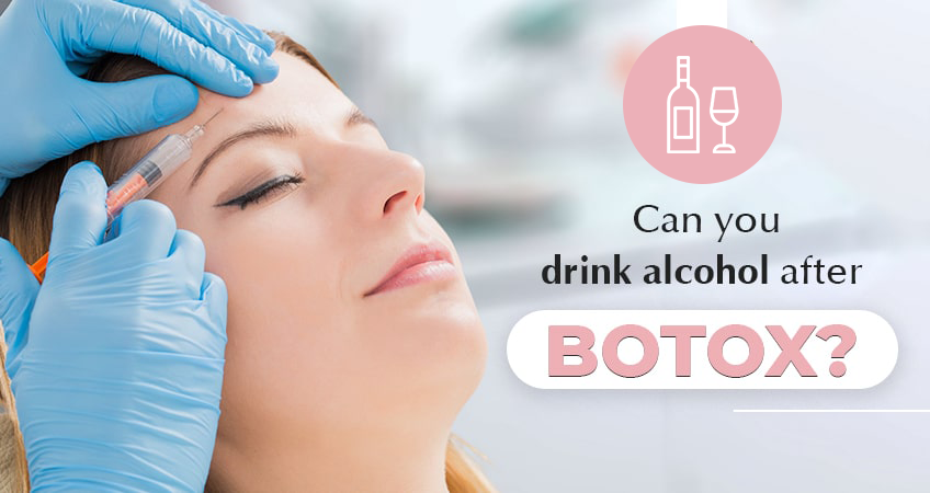 Can you drink alcohol after botox?
