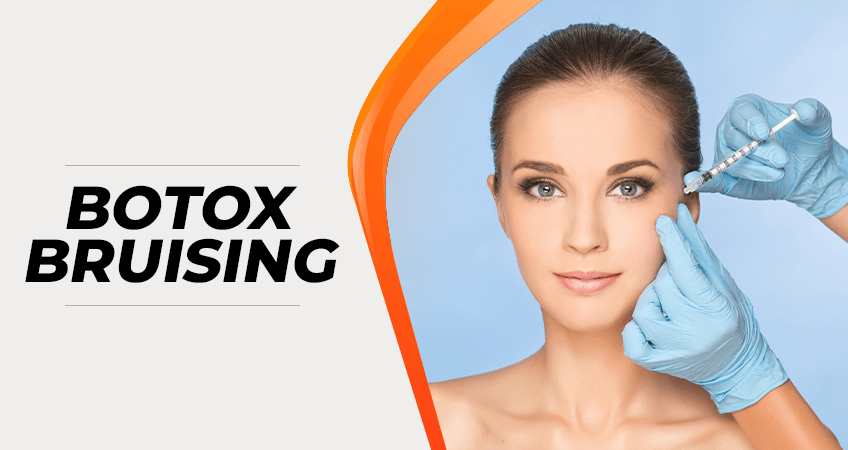 A guide to Botox bruising by Moon Aesthetics